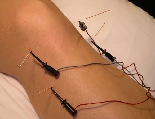 Electro-Acupuncture