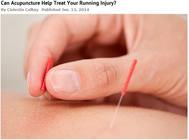 How Acupuncture in Palm Harbor Helps You Deal with Running Injuries