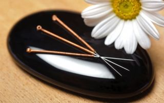 alternative medicine with acupuncture