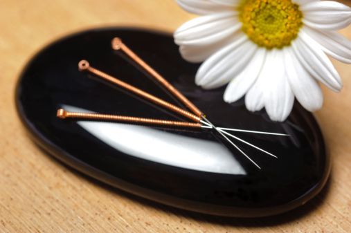 alternative medicine with acupuncture