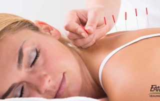 types-of-acupuncture