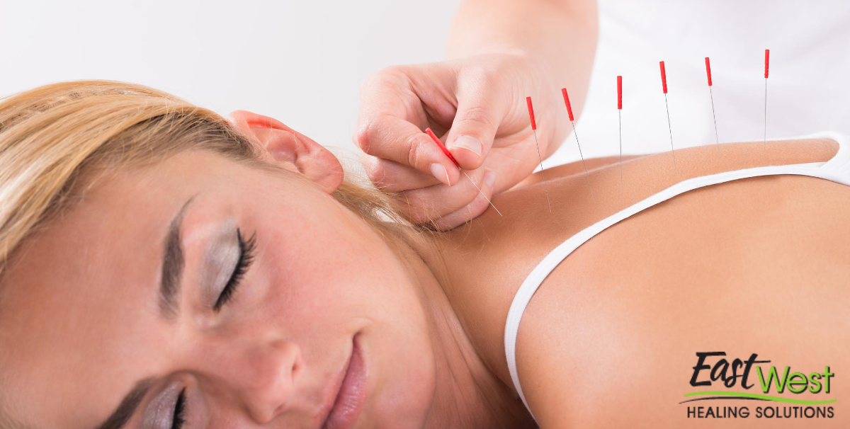 facts-about-acupuncture