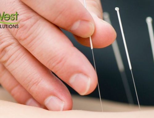 How Does Acupuncture Help with Stress Relief?