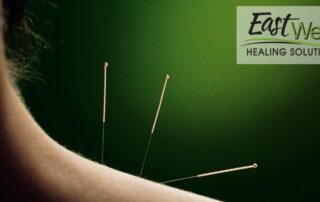acupuncture-for-pinched-nerves