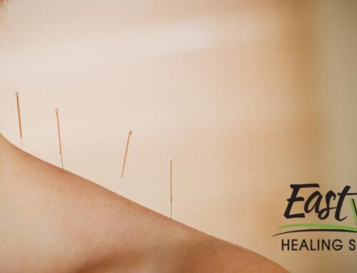 8 Benefits of Acupuncture for Chronic Pain