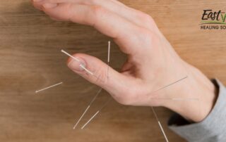 what-can-acupuncture-treat