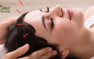 acupuncture-for-fertility