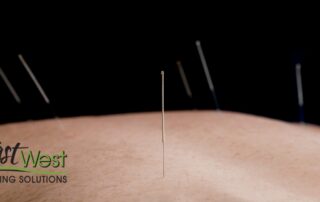 does-acupuncture-hurt