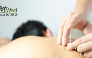acupuncture-for-allergies