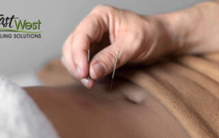 acupuncture-weight-loss