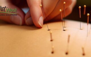 acupuncture-for-neuropathy