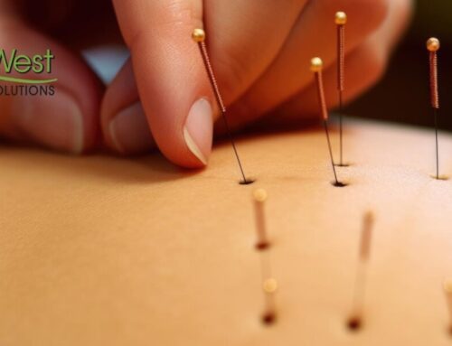 How Can Acupuncture Treat Neuropathy?